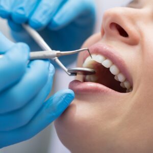Dentist,Examining,A,Patient's,Teeth,In,The,Dentist.